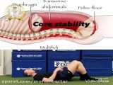 تقویت عضلات شکم و کمر _مراجع مبتلا به اسکولیوز_کاردرمانی جسمی