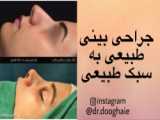 نمونه ای از جراحی زیبایی بینی
