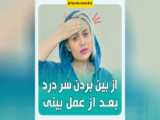 سر درد بعد از جراحی بینی