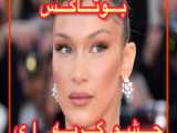 لیفت با نخ برای صورت