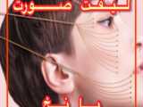 آیا لیزر درد دارد؟