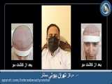 کاشت با روش خفن
