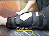 جراحی کرانیوسینوستوز