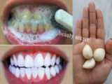 سفید کردن و جرم گیری دندان در 1 دقیقه! راهکار سفید شدن دندان