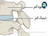 درمان کمردرد و قوز کمر با ۳ تمرین کششی