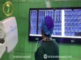 دکتر سعید احتشامی - جراحی تنگی کانال نخاعی