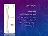 میرینگوتومی