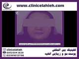 ژل جوانسازی جالپرو