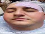 بهترین ماسک های صورت