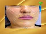 لیفت صورت با نخ بهتر است یا جراحی؟