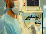 لیفت چشم بدون جراحی