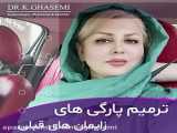 لیزر بدون عوارض !