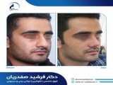 جراحی بینی ریحان