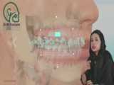 عمل زیبایی بینی و ارتودنسی
