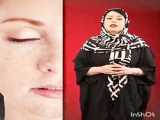 یه راه حل ساده برای درمان لک