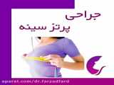 جراحی پروتز سینه چیست؟ | پروتز پستان اصفهان