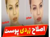 اموزش از بین برن زردی عکس در فتوشاپ