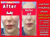 جراحی چشم سگ