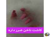 کاشنن ناخن ضر داره