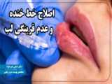 فقط با یک سی سی!