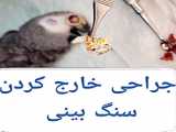 جراحی کشیدن دندان کارناسیال