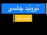 آشنایی با تیروئید چشمی- قسمت دوم کنترل بیماری