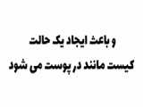 مزایای درمان شقاق با لیزر پرتوان