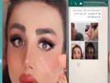 قبل و بعد عمل زیبایی بینی