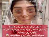 آرایش زیبای صورت