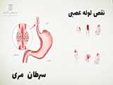 شنیدین که میگن برنج پخته شده رو 2 بار گرم نکنین؟