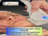 پلاسما ژل دست