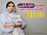 بهترین مرکز هایفو در اصفهان