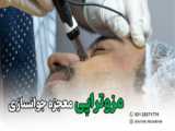 جلسه اول لیزر
