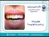 پیوند استخوان در ایمپلنت های دندانی | بهترین ایمپلنت اصفهان