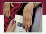 فیلر لب به سبک روسی