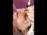 تزریق فیلر روسی
