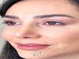 نتیجه باورنکردنی کاشت ابرو
