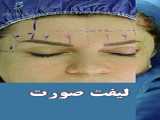 جوانسازی صورت به چند روش انجام میشه؟