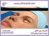 زیبایی چشم