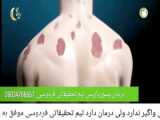 مشکلات مفاصل
