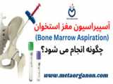 بیوپسی و آسپیراسیون مغز استخوان چگونه انجام می شود؟