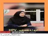زگیل تناسلی و  طب سنتی