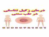 درمان زگیل با طب سنتی