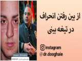 جراحی بینی ، زیبا جو آقا