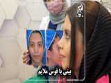 جراحی زیبایی بینی توسط دکتر علیـــرضا صابــری