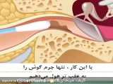 گوش پاک کن