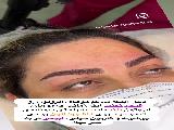 میکروبلیدینگ