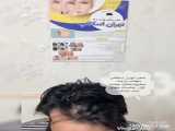 لک دندان