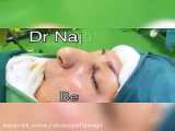 فیلم جراحی عصب شکم