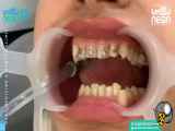 ارتودنسی و روش گذاشتنشو ببینید